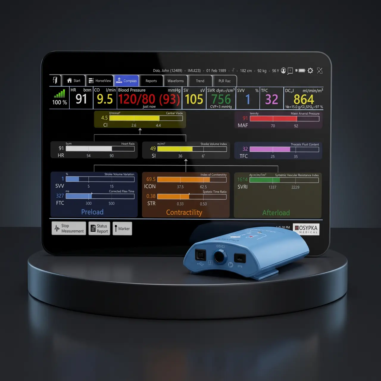 Monitor hemodinámico ICON con su módulo azul, sobre un pedestal